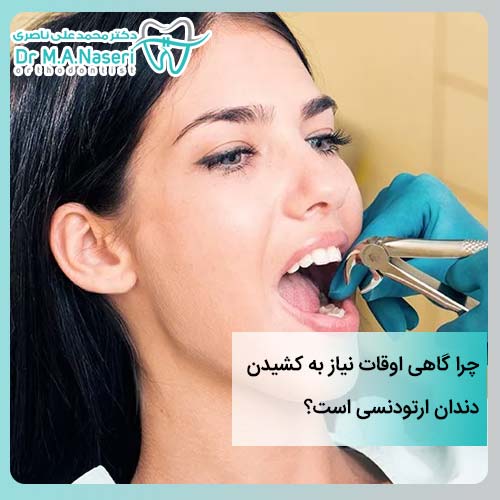 کشیدن دندان ارتودنسی