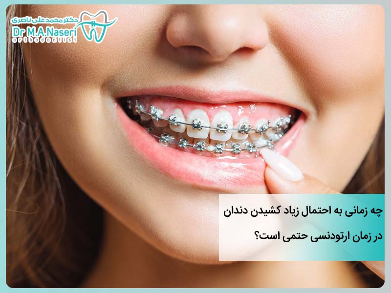 دلایل کشیدن دندان ارتودنسی